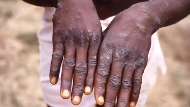 Africa Leads Global Mpox Cases – WHO